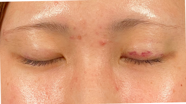 手术前的状态 其一