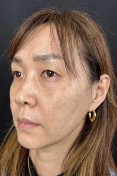 手术前的状态 其一