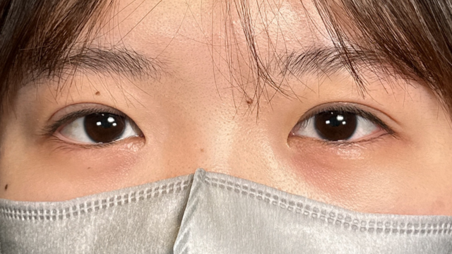 手术前的状态 其一