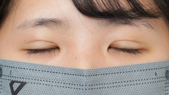 手术前的状态 其一