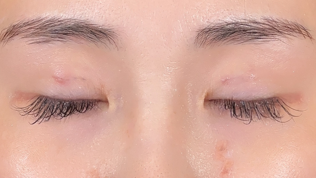 手術前の状態 その1