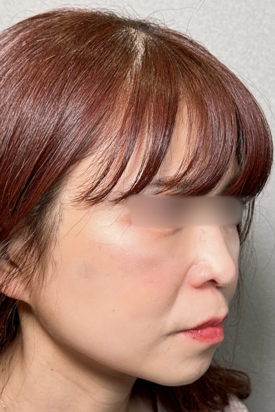 Postoperative Condition Part 1