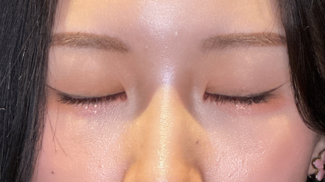 手术前的状态 其一