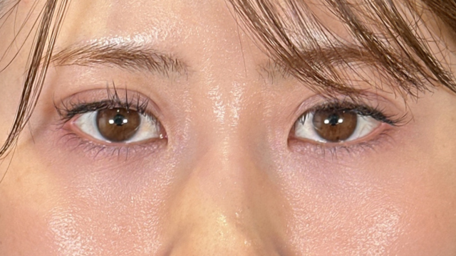 手术前的状态 其一