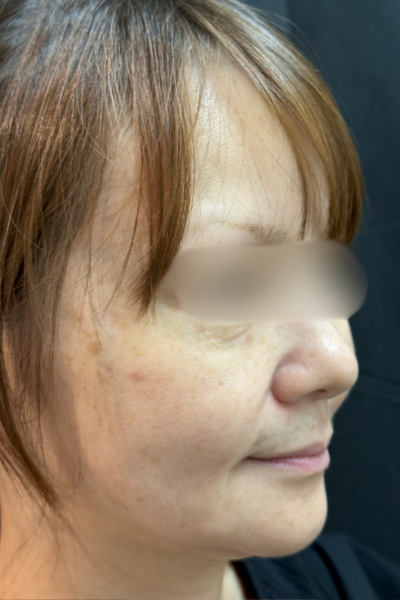 手術前の状態 その1