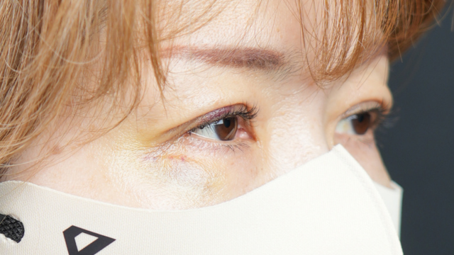 手術前の状態 その1