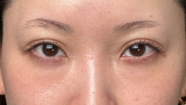 Postoperative Condition Part 1