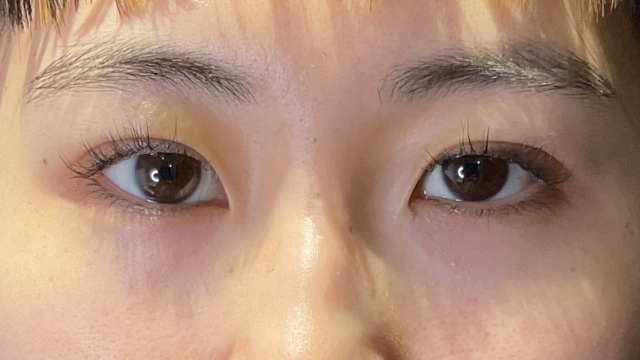 手术前的状态 其一