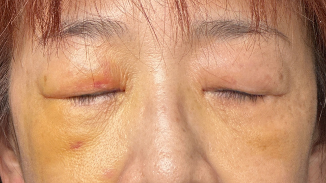 手术前的状态 其一