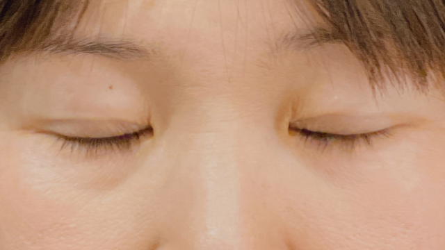 手术前的状态 其一