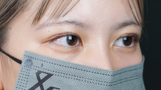 手術前の状態 その1