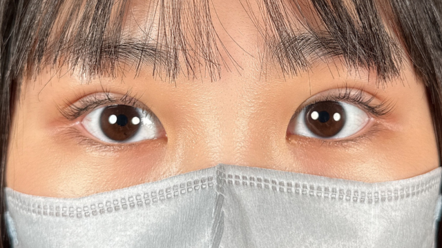 手术前的状态 其一