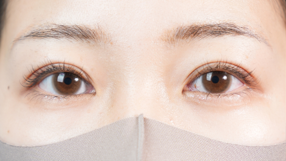 手術前の状態 その1