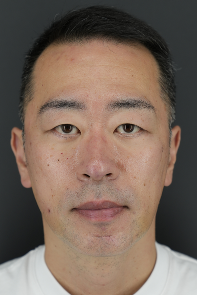 手術前の状態 その1