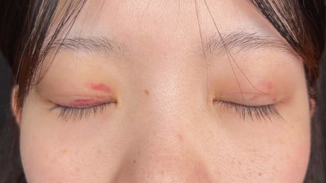 手术前的状态 其一