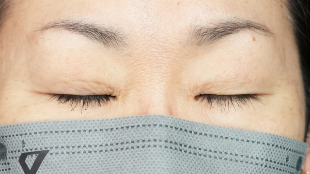 手術前の状態 その1