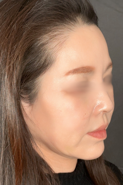 手術前の状態 その1