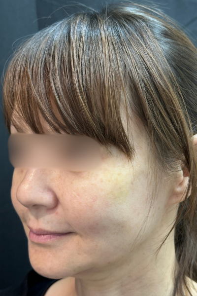 手術前の状態 その1