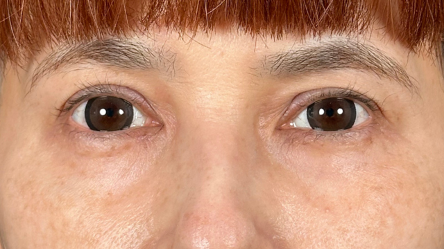 手术前的状态 其一