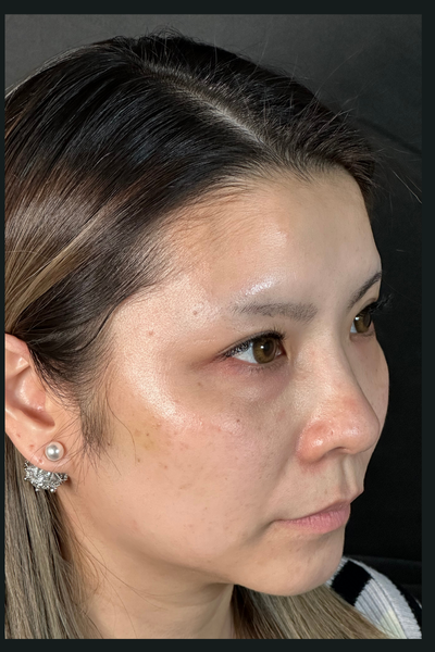 手术前的状态 其一