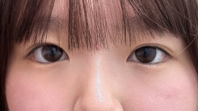 手术前的状态 其一