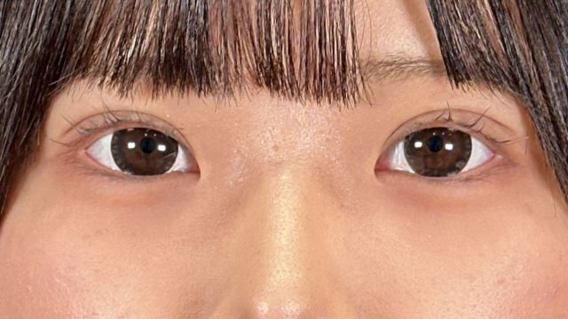 手術前の状態 その1