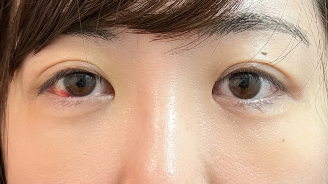 手术前的状态 其一