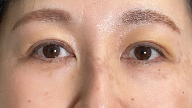 手术前的状态 其一