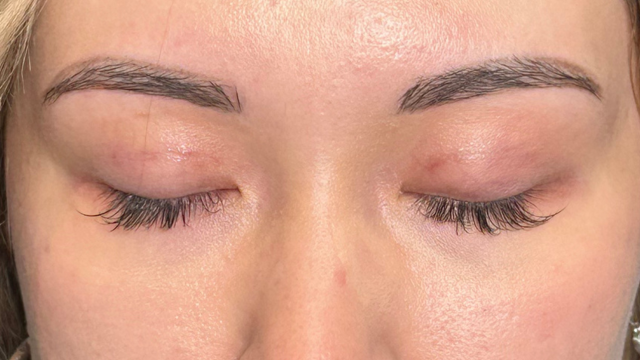 手术前的状态 其一