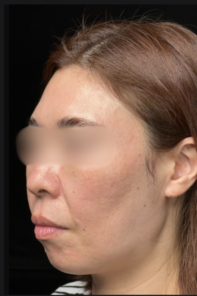 手術前の状態 その1