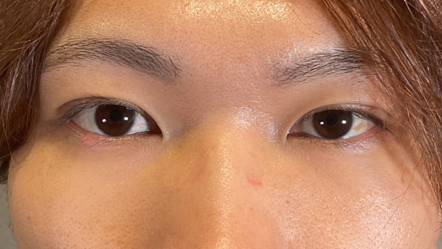 Postoperative Condition Part 1