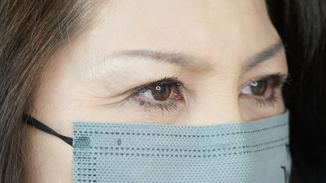 手术前的状态 其一