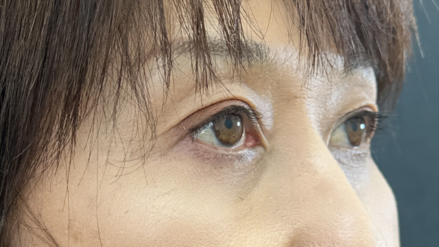 手术前的状态 其一