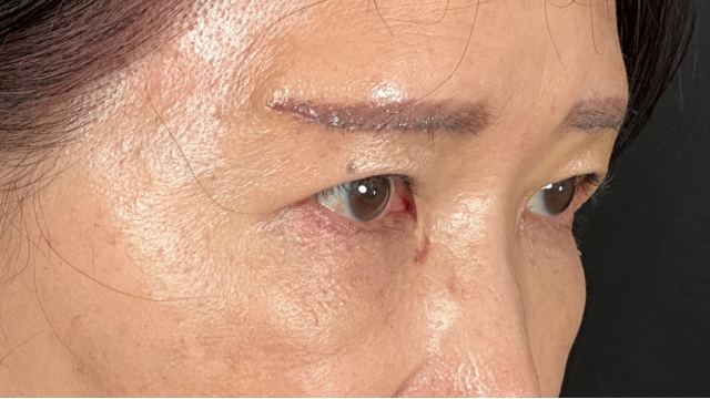 手術前の状態 その1