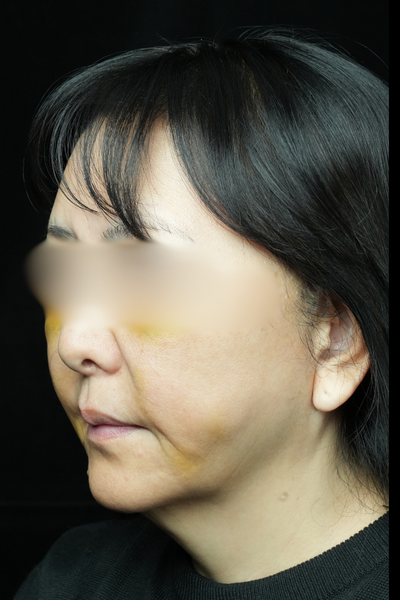 手術前の状態 その1