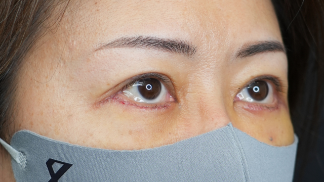 Postoperative Condition Part 1