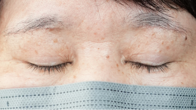 手术前的状态 其一