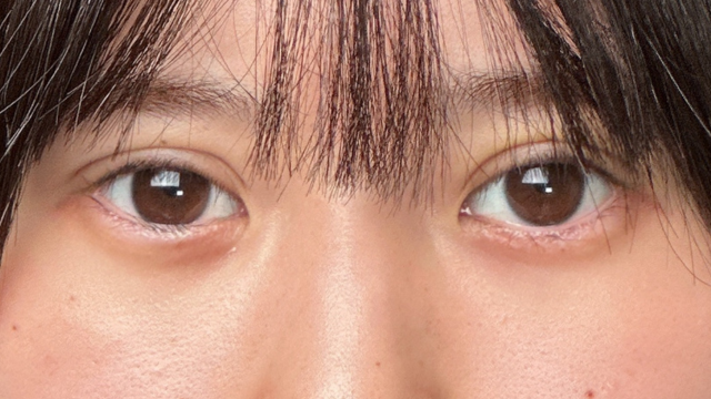 手术前的状态 其一