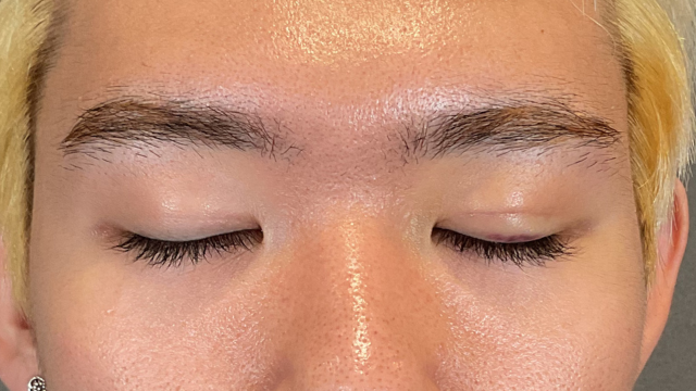 Postoperative Condition Part 1