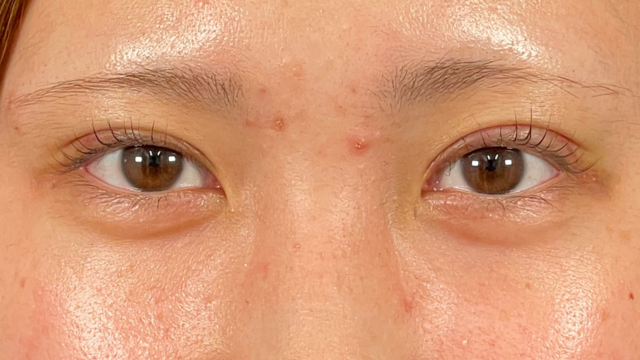 手术前的状态 其一