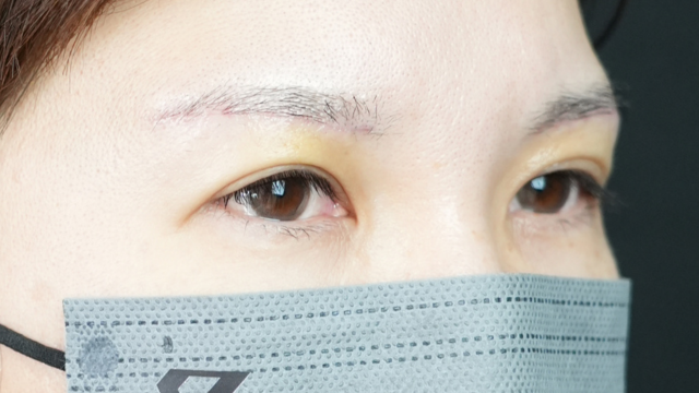 Postoperative Condition Part 1