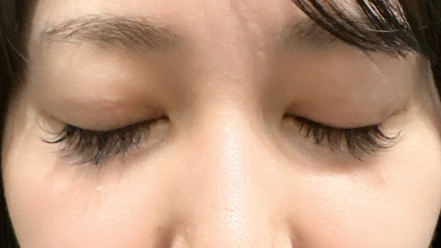 Postoperative Condition Part 1