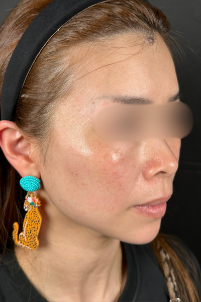 手术前的状态 其一