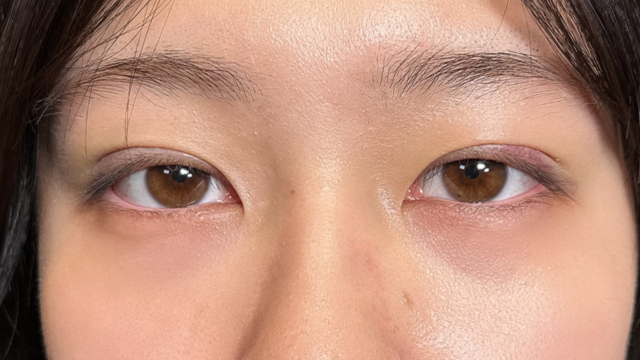 手术前的状态 其一