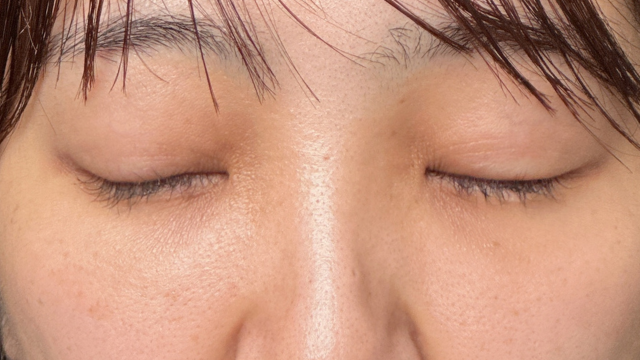 Postoperative Condition Part 1