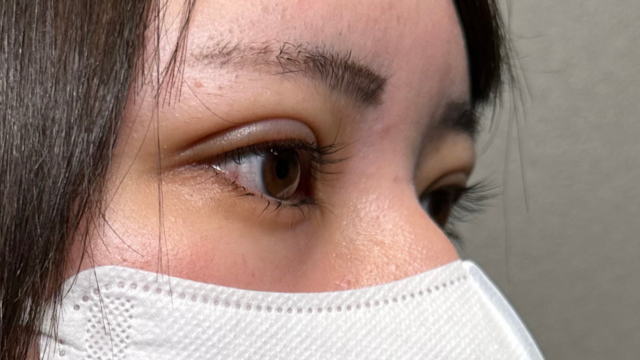 手術前の状態 その1