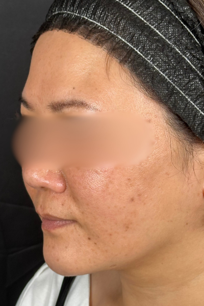 手術前の状態 その1