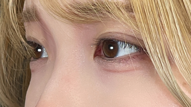 手術前の状態 その1