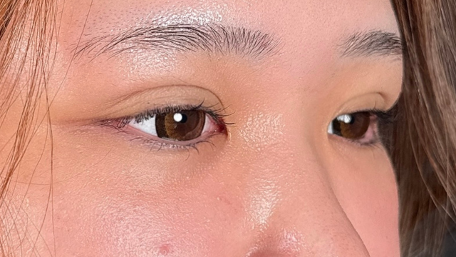 手术前的状态 其一