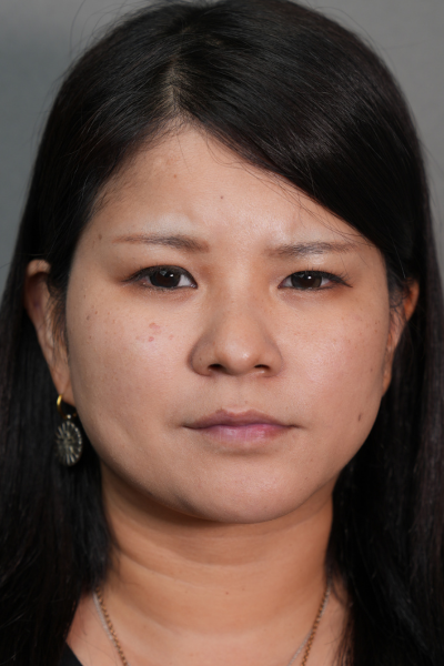 手術前の状態 その1